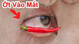 Bị ớt văng vào mắt phải làm sao ? cách làm hết nóng bỏng khi ớt dính vào người , ớt bắn vào mắt khi cay nóng