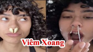 Cách trị viêm xoang mũi hiệu quả tại nhà - Bài thuốc nam dân gian trị viêm xoang bằng cây trinh nữ hoàng cung