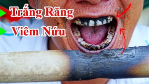 4 Cách làm trắng sáng răng tự nhiên , vừa rẻ tiền vừa đạt hiệu quả cao - Cách làm trắng răng bằng than tre hoạt tính