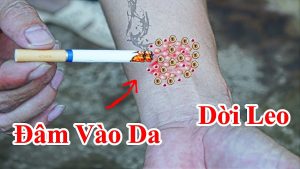 Cách trị giời leo hiệu quả trong vài ngày bạn nên biết - Bài thuốc dân gian trị dời leo tại nhà - Giời leo gì gì ?