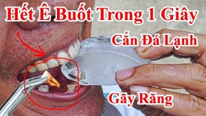 Cách làm hết ê buốt răng trong 1 giây cực hay - Mẹo làm hết e buốt răng khi uống nước đá , ăn đồ nóng lạnh